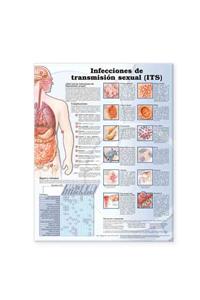 Sexually Transmitted Infections Anatomical Chart in Spanish (Infecciones de transmisión sexual)