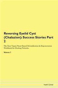 Reversing Eyelid Cyst (Chalazion): Succe