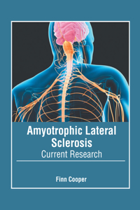 Amyotrophic Lateral Sclerosis: Current Research