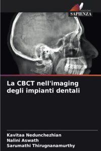 CBCT nell'imaging degli impianti dentali