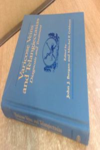 Varicose Veins and Telangiectasias