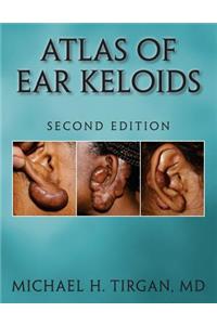 Atlas of Ear Keloids - Second Edition