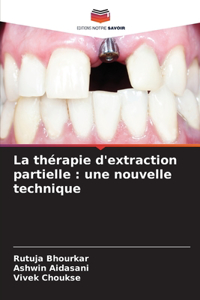thérapie d'extraction partielle