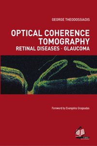 Optical Coherence Tomography Retinal Diseases - Glaucoma
