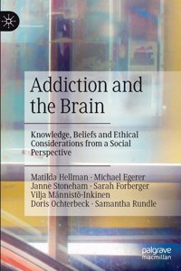 Addiction and the Brain