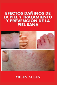 Efectos Dañinos de la Piel Y Tratamiento Y Prevención de la Piel Sana