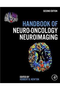 Handbook of Neuro-Oncology Neuroimaging