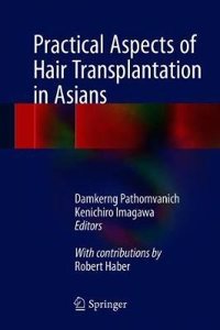 Practical Aspects of Hair Transplantation in Asians