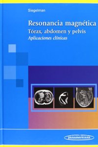 Resonancia Magnetica: Torax, Abdomen Y Pelvis. Aplicaciones Clinicas