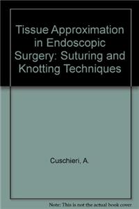 Endoscopic Knots Sutures Bk&cd-ROM