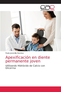 Apexificación en diente permanente joven