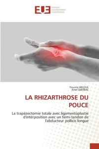 Rhizarthrose Du Pouce