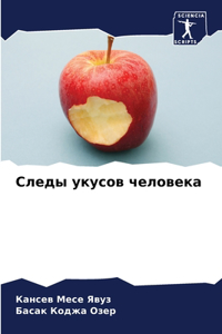 Следы укусов человека