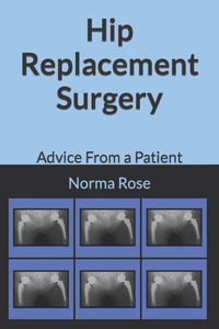 Hip Replacement Surgery