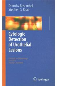 Cytologic Detection of Urothelial Lesions