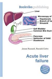 Acute Liver Failure