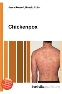 Chickenpox