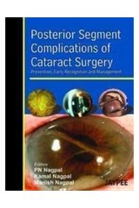 Posterior Segment Complications of Cataract Surgery