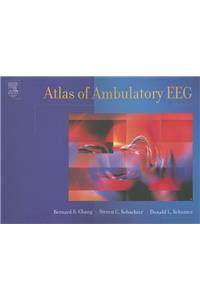 Atlas of Ambulatory EEG