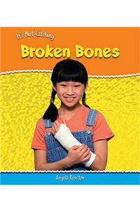 It's Not Catching: Broken Bones