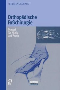 Orthopadische Fuchirurgie