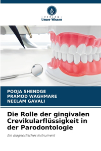 Rolle der gingivalen Crevikularflüssigkeit in der Parodontologie