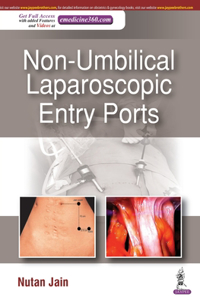 Non-Umbilical Laparoscopic Entry Ports