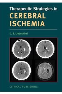 Cerebral Ischemia