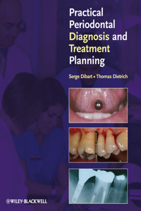 Practical Periodontal Diagnosis and Treatment Planning