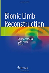 Bionic Limb Reconstruction