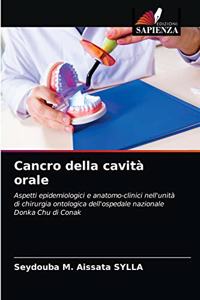 Cancro della cavità orale