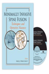 MINIMALLY INVASIVE SPINE FUSION 2