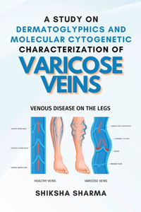 Study on Dermatoglyphics and Molecular Cytogenetic Characterization of Varicose Veins