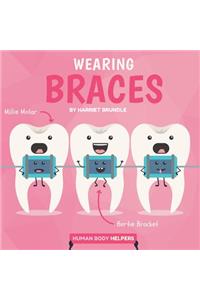 Wearing Braces