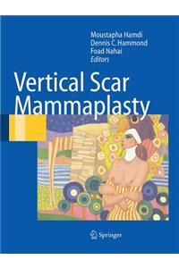 Vertical Scar Mammaplasty