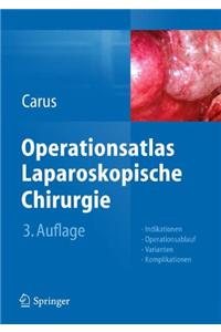 Operationsatlas Laparoskopische Chirurgie