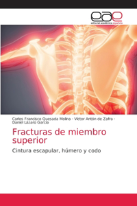 Fracturas de miembro superior