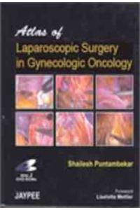 Atlas of Laparoscopic Surgery in Gynecologic Oncology with 2 DVD-ROMs