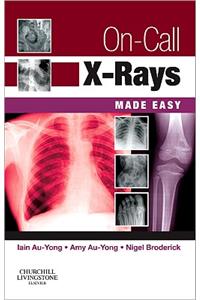 On-Call X-Rays Made Easy