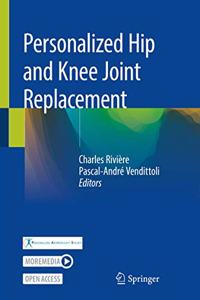 Personalized Hip and Knee Joint Replacement