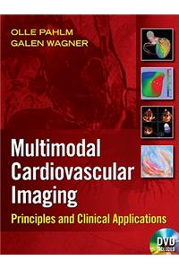 Multimodal Cardiovascular Imaging: Principles and Clinical Applications [With DVD]