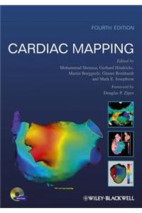 Cardiac Mapping