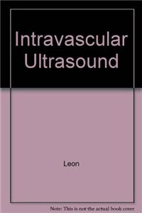 Intravascular Ultrasound