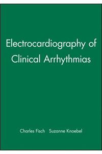 Electrocardiography of Clinical Arrhythmias