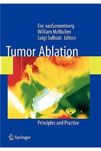 Tumor Ablation