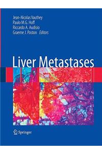 Liver Metastases