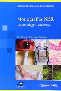 Monografias Ser. Reumatologia Pediatrica