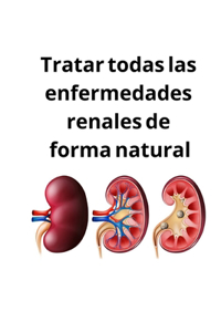 Tratar todas las enfermedades renales de forma natural