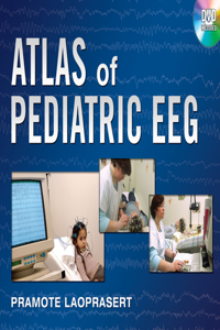 Atlas of Pediatric Eeg