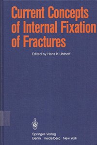 Current Concepts of Internal Fixation of Fractures